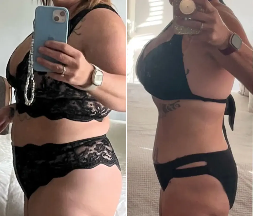 Raquel — antes e depois com a Bloom